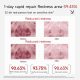 UNES YEAST REPAIR FREEZE-DRIED POWDER