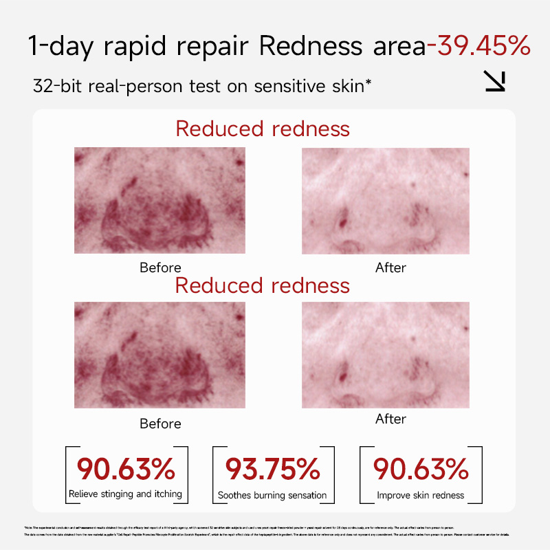 UNES YEAST REPAIR FREEZE-DRIED POWDER