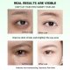 SEYE Aloe Vera Under Eye Patches