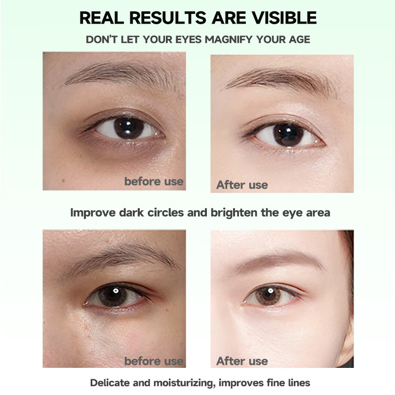 SEYE Aloe Vera Under Eye Patches