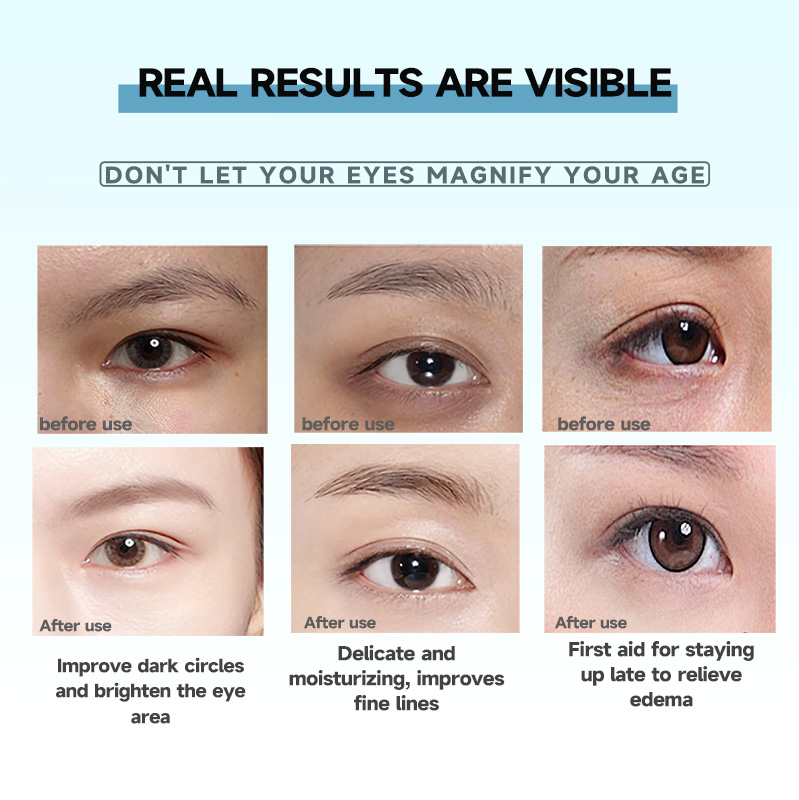 SEYE Retinol Collagen Under Eye Mask