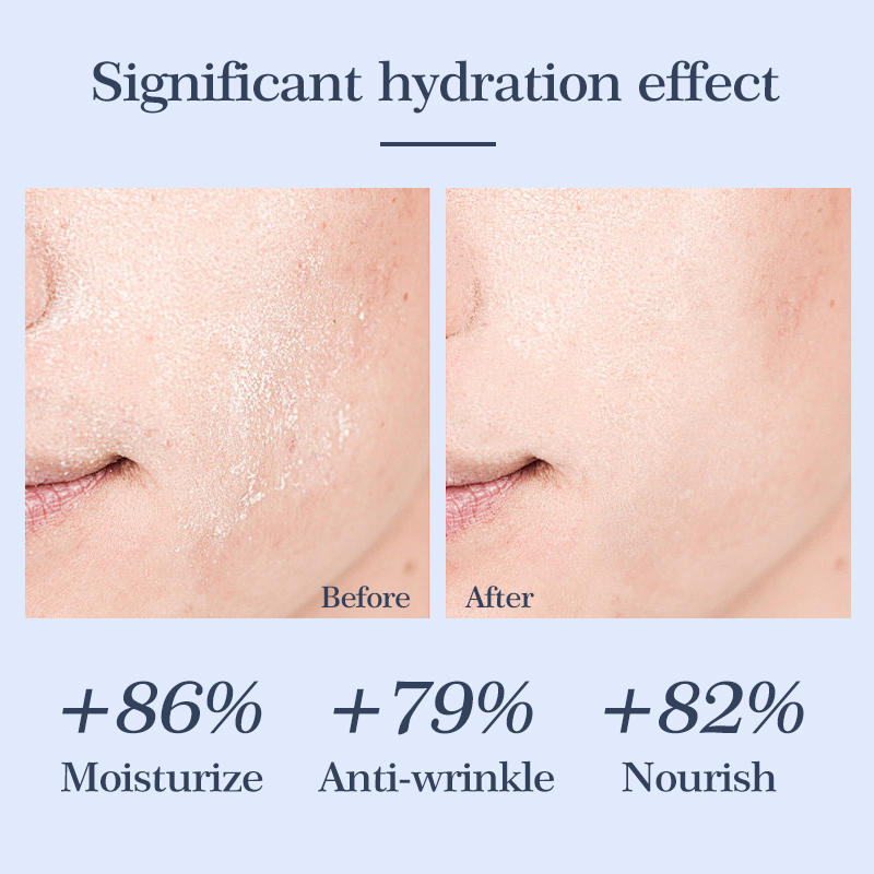 SEYE Hyaluronic Acid Deep Moisturizing Cream