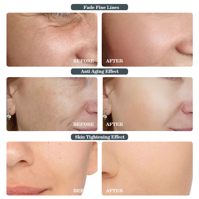SEYE Retinol Face Cream