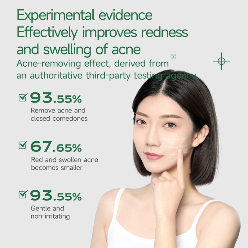UNES Anti Ance Face Cream