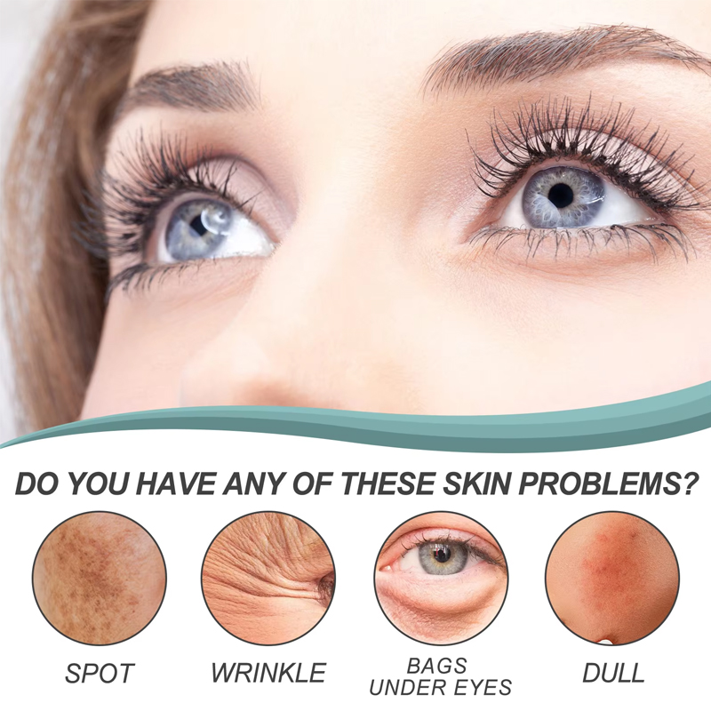 SEYE Dark Spot Face Cream