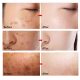 SEYE Anti-Freckle Brightening Cream