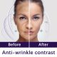 UNES 5% Retinol & Collagen Face Cream