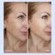 SEYE Ceramide Essence