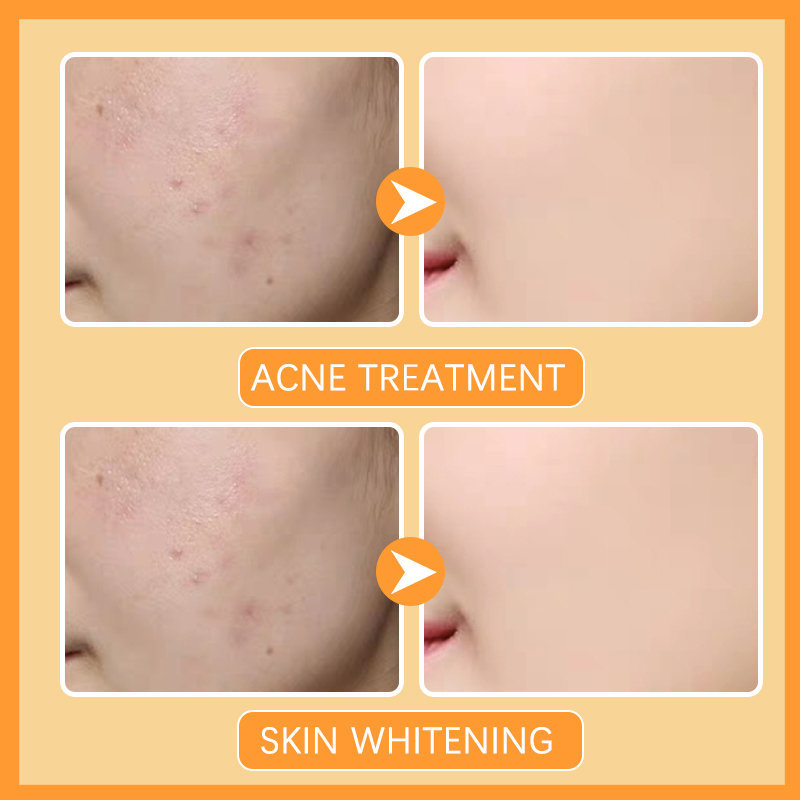 SEYE Turmeric Face Cream