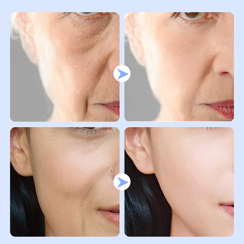 SEYE Ceramide Face Cream
