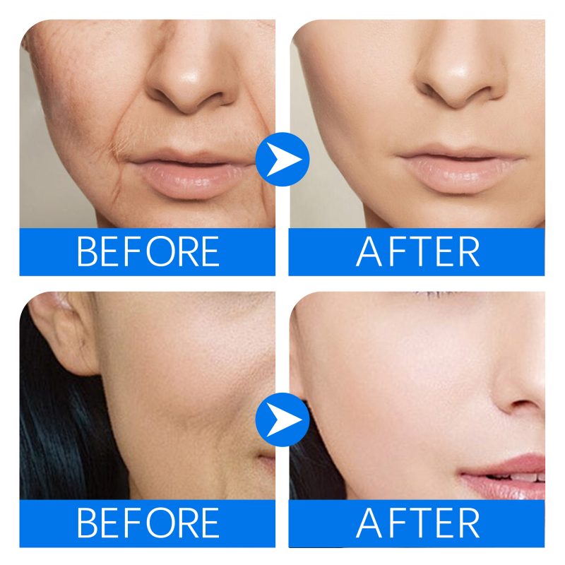 SEYE 4% Hyaluronic Acid Serum Cream