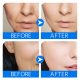 SEYE 4% Hyaluronic Acid Serum Cream