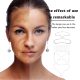SEYE Anti Wrinkle Silicone Face Patch