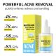 SEYE Sakicylic Acid Anti-Acne Serum