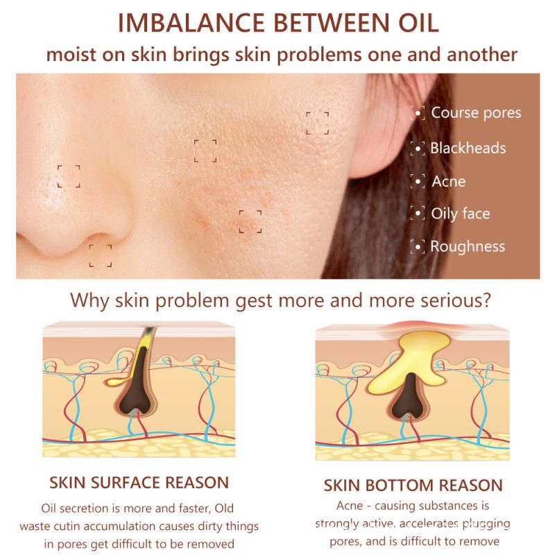 SEYE Pore Minimizer Serum
