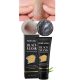 SEYE Nose Charcoal Blackhead Remover Mask