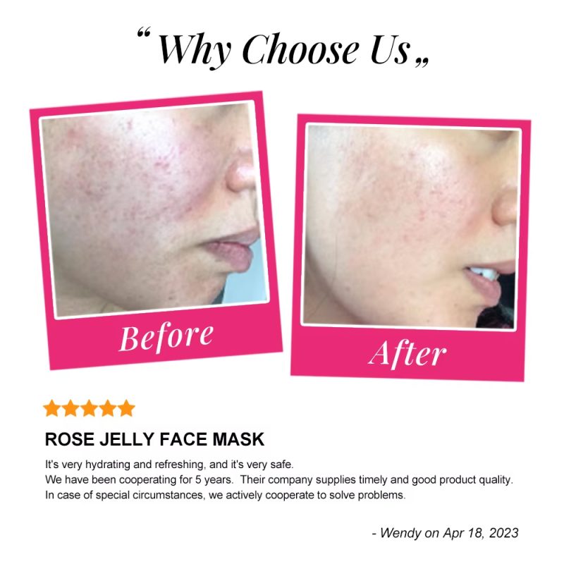 SEYE Jelly Face MASK