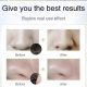 SEYE Nose Charcoal Blackhead Remover Mask