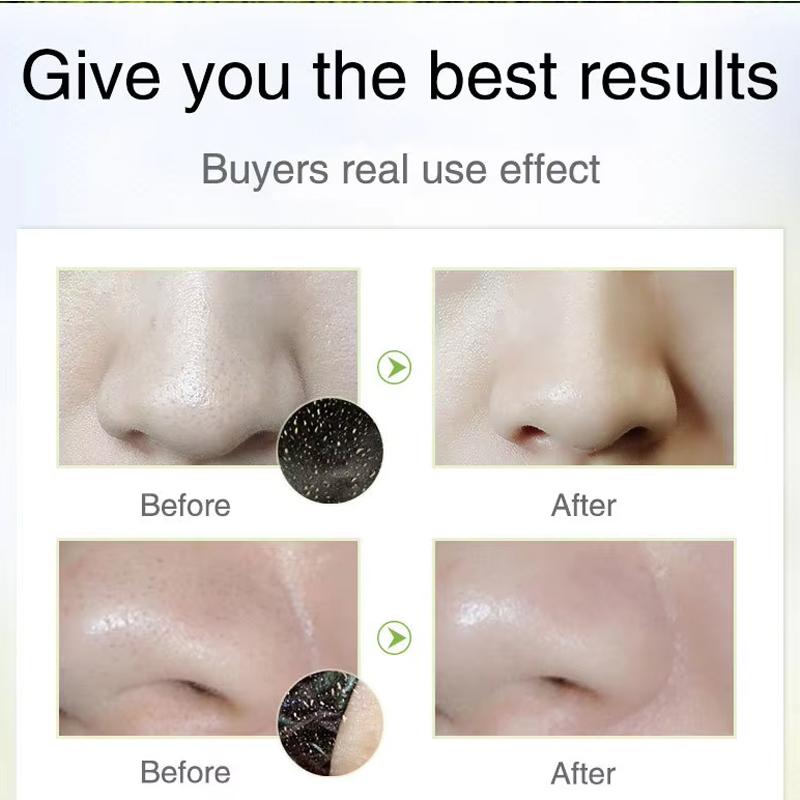 SEYE Nose Charcoal Blackhead Remover Mask