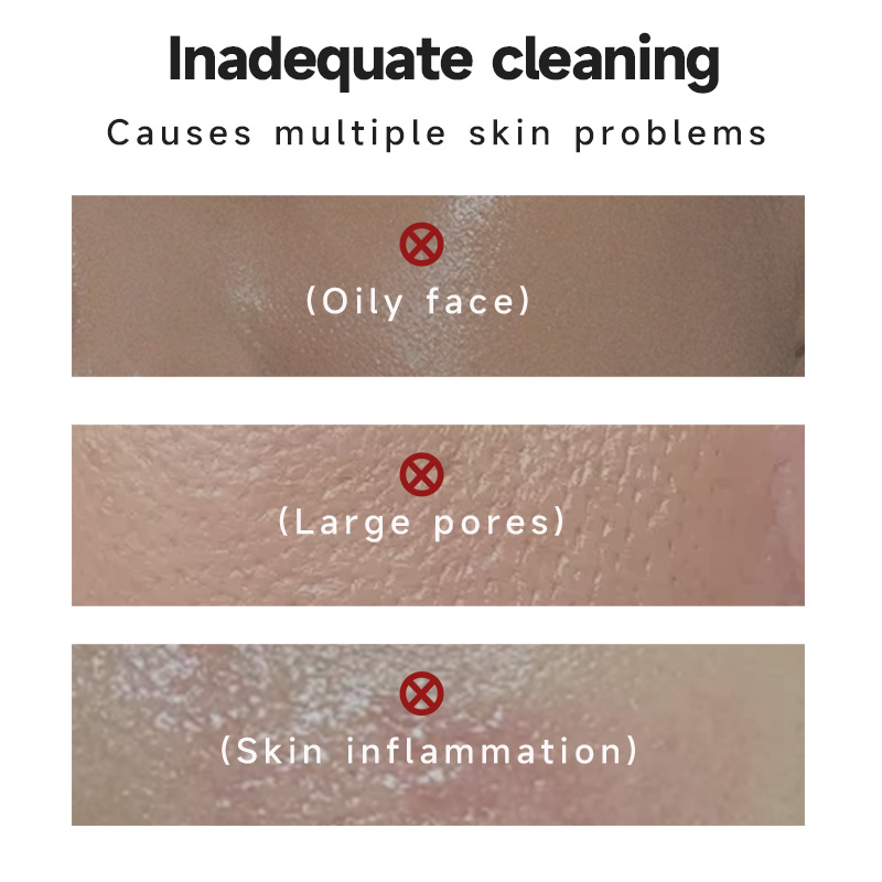 SEYE Mugwort Cleansing Mud Mask