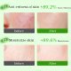 SEYE Aloe Face Mask