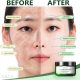 SEYE Tea Tree Clay Mask