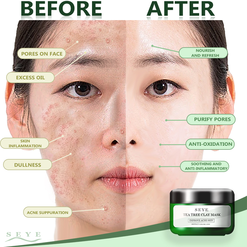 SEYE Tea Tree Clay Mask