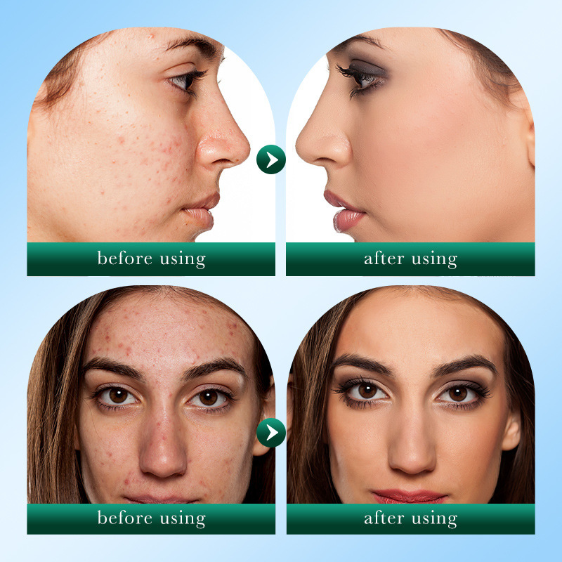 SEYE Tea Tree Facial Cleanser