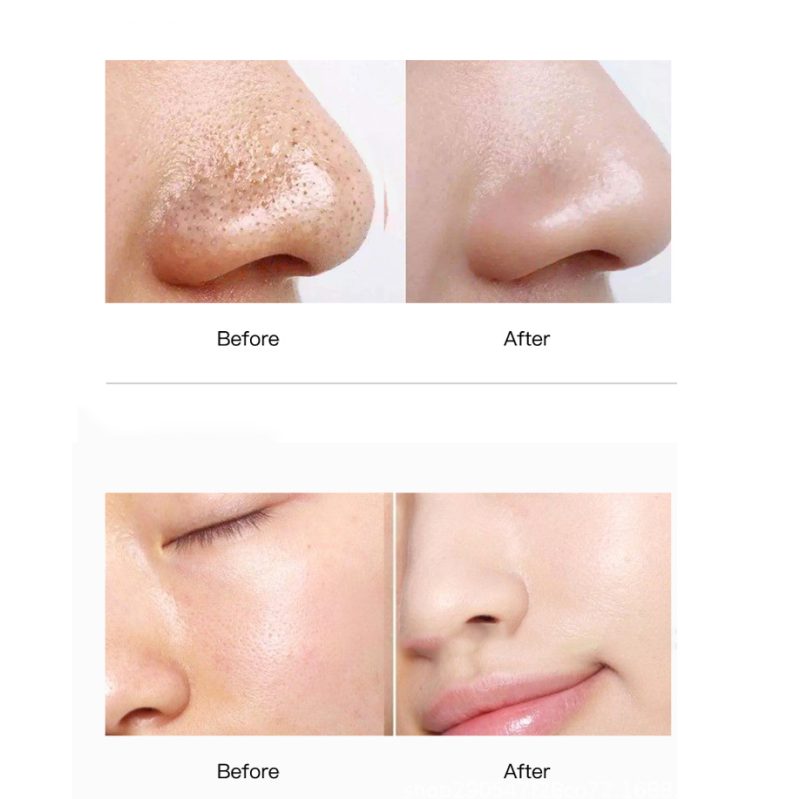 SEYE Collagen Mud Mask