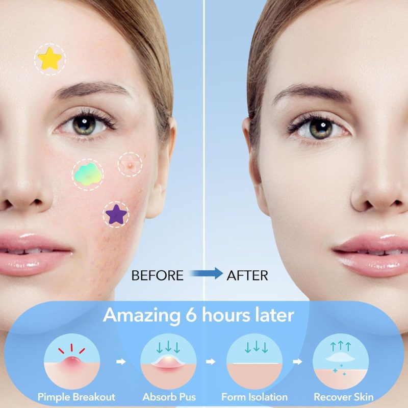 SEYE Acne Patch