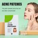 SEYE Acne Treatment Pads