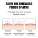 SEYE Acne Treatment Pads