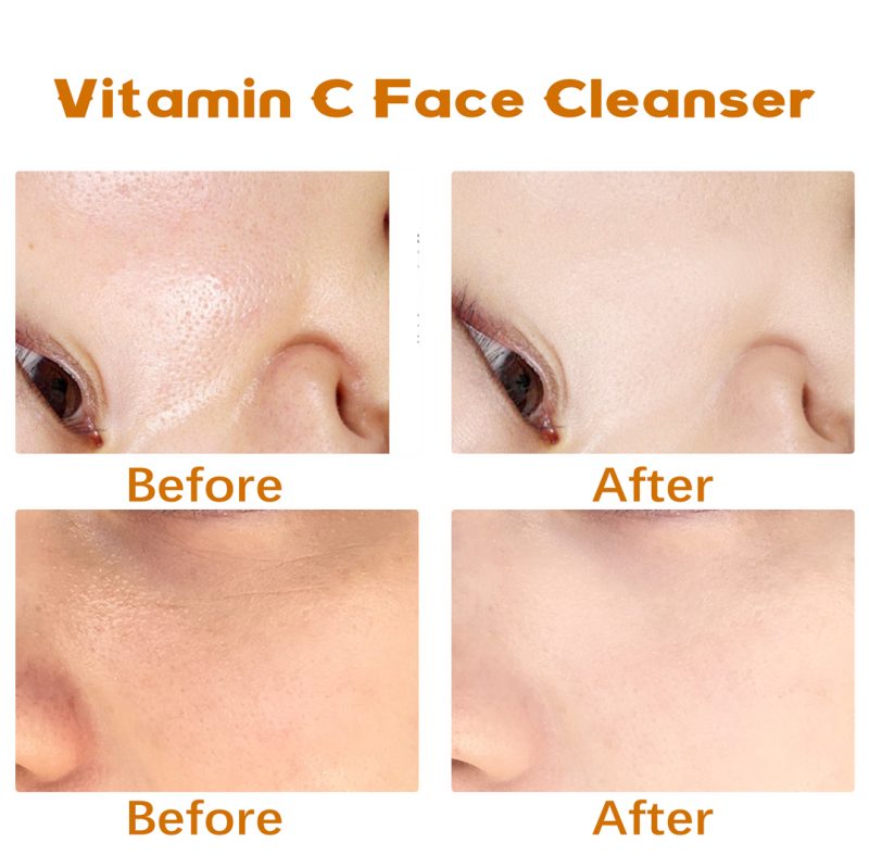SEYE Vitamin C Face Cleanser