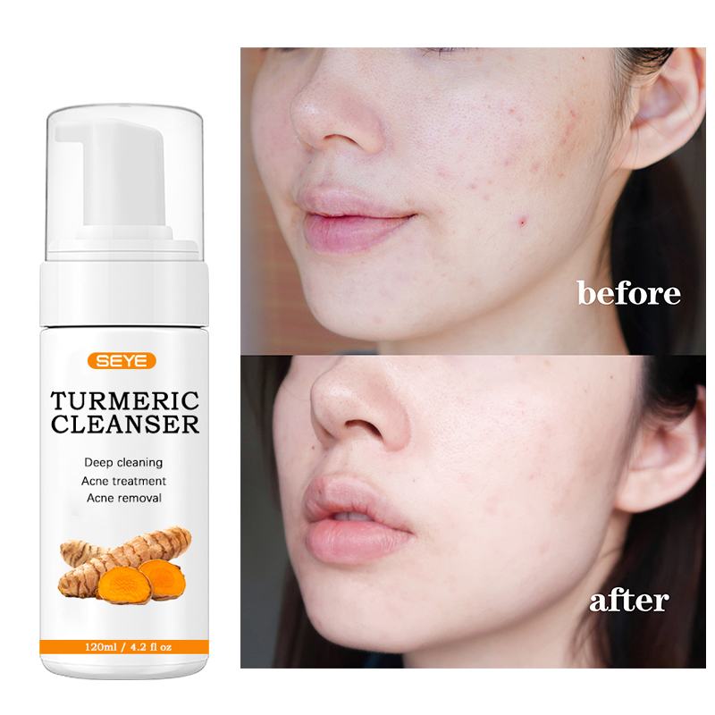 SEYE Turmeric Fcae Cleanser