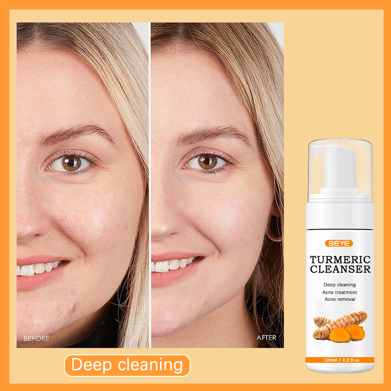 SEYE Turmeric Fcae Cleanser