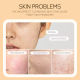 SEYE Collagen Cleansing Foam